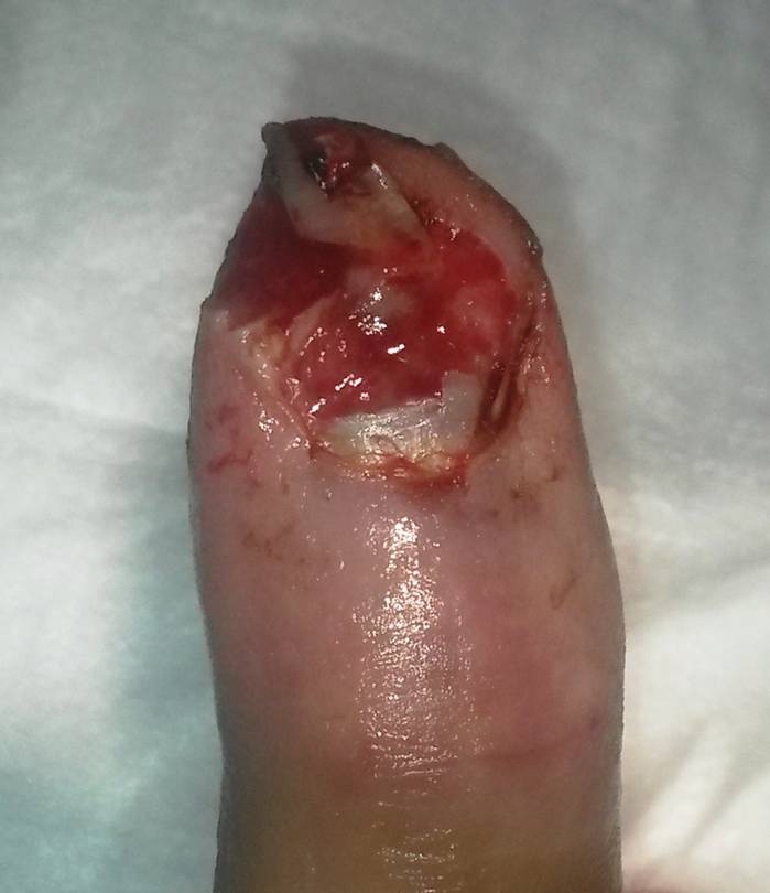 Before_Surgery