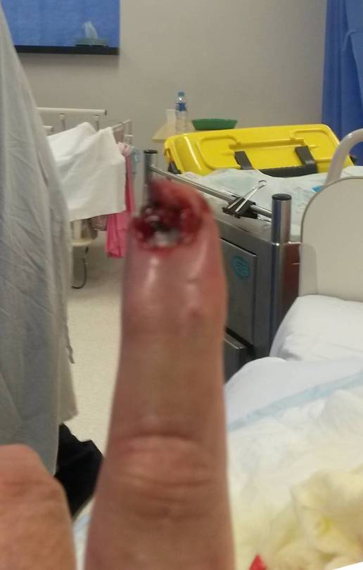 In_Emergency_Room